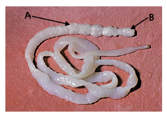 <p>The image above is of a tapeworm (gross). Structure&nbsp;<strong>A&nbsp;</strong>is a single _______________, and structure&nbsp;<strong>B&nbsp;</strong>is a/an _______________.</p>