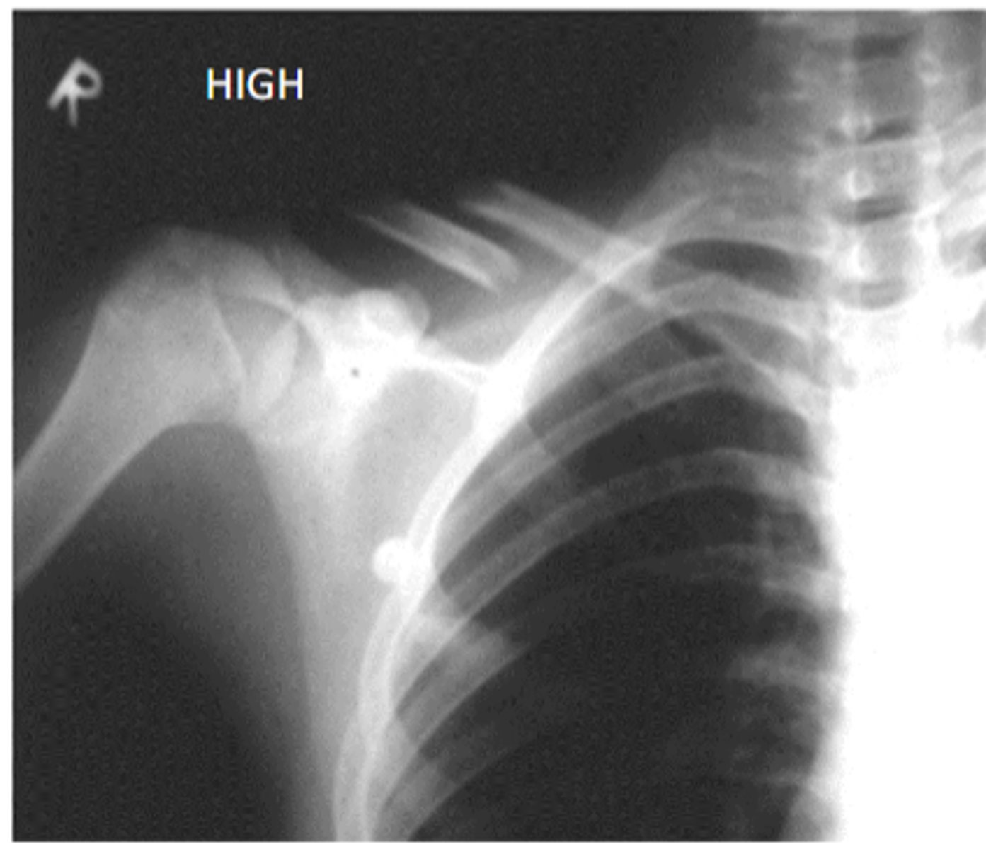 <p>high contrast</p>