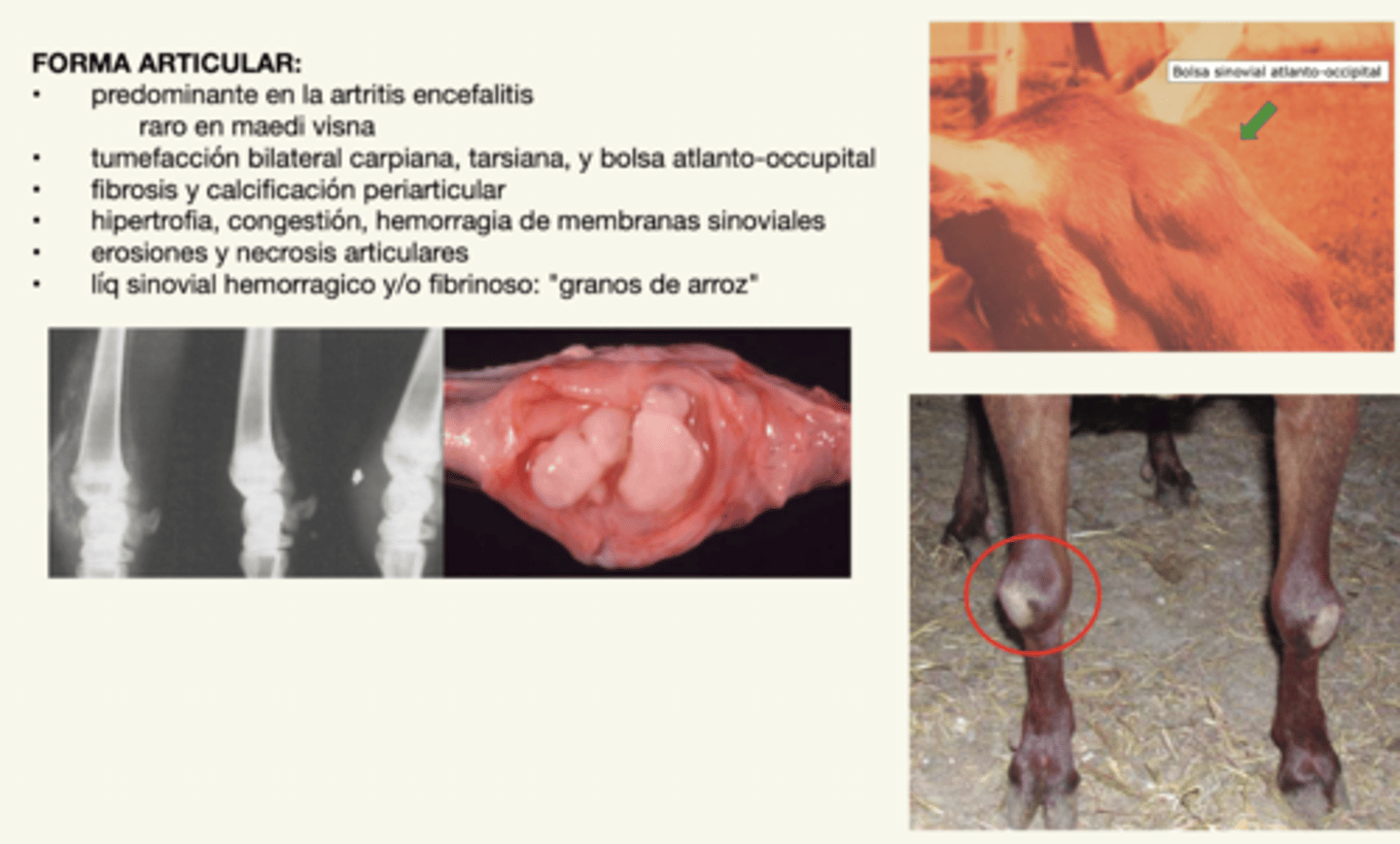 <p>- tumefacción bilateral</p><p>- fibrosis y calcificación</p><p>- hipertrofia, congestión, y hemorragia de membranas sinoviales</p><p>- erosiones, necrosis articular</p><p>- líquido sinovial hemorragico y fibrinoso ("granos de arroz")</p><p>★ afecta a los tarsos, carpos, y art. atlanto-occipital</p>
