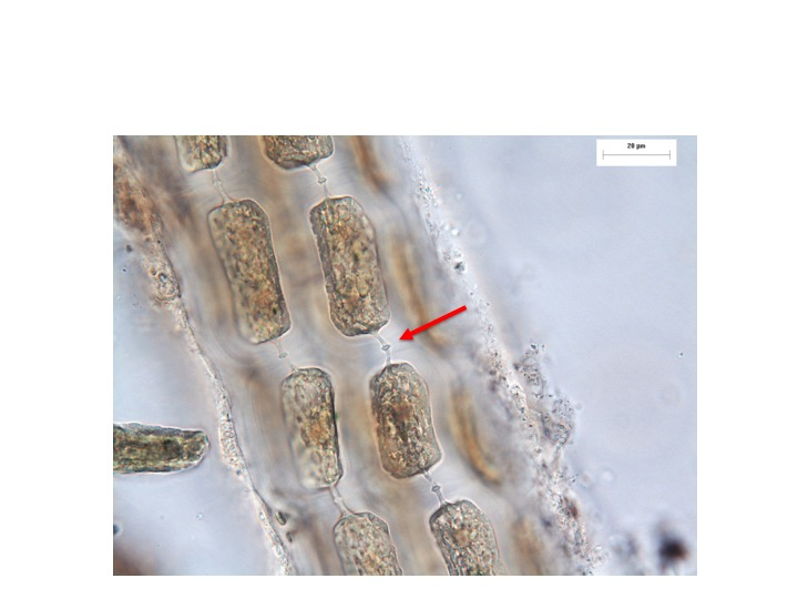 <p>What structure is indicated by the pointer?</p><p>Pit connection</p><p>Incomplete cytokinesis</p><p>False branching</p><p>True branching</p>
