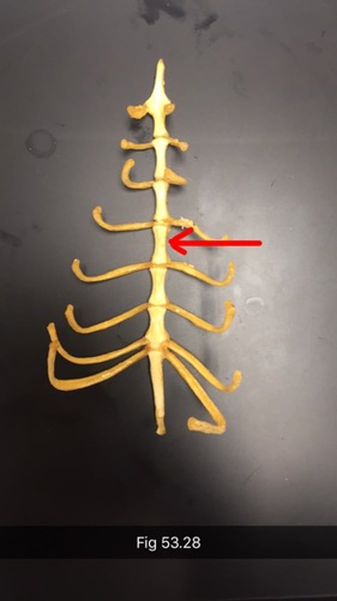 <p>The individual bones that fuse to form the sternum</p>