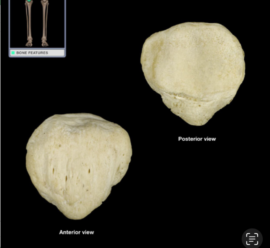 <p>What is the name of the bone</p>