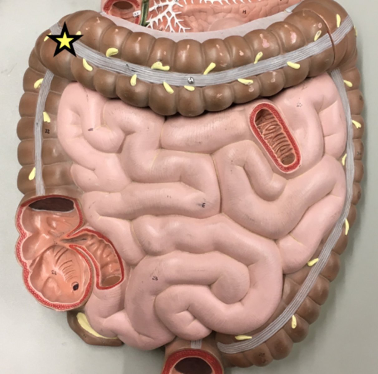 <p>Name this curvature (or turn)</p>