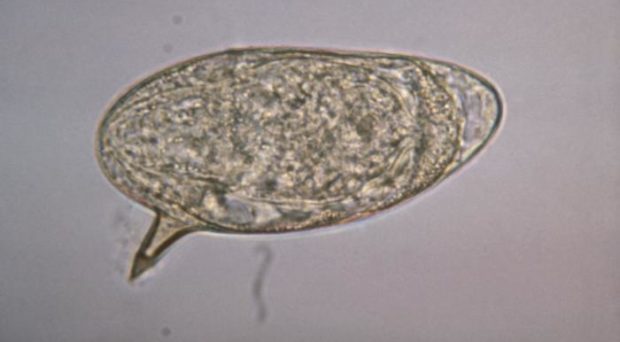 <p><em><span>Schistosoma mansoni</span></em><span> egg</span></p>