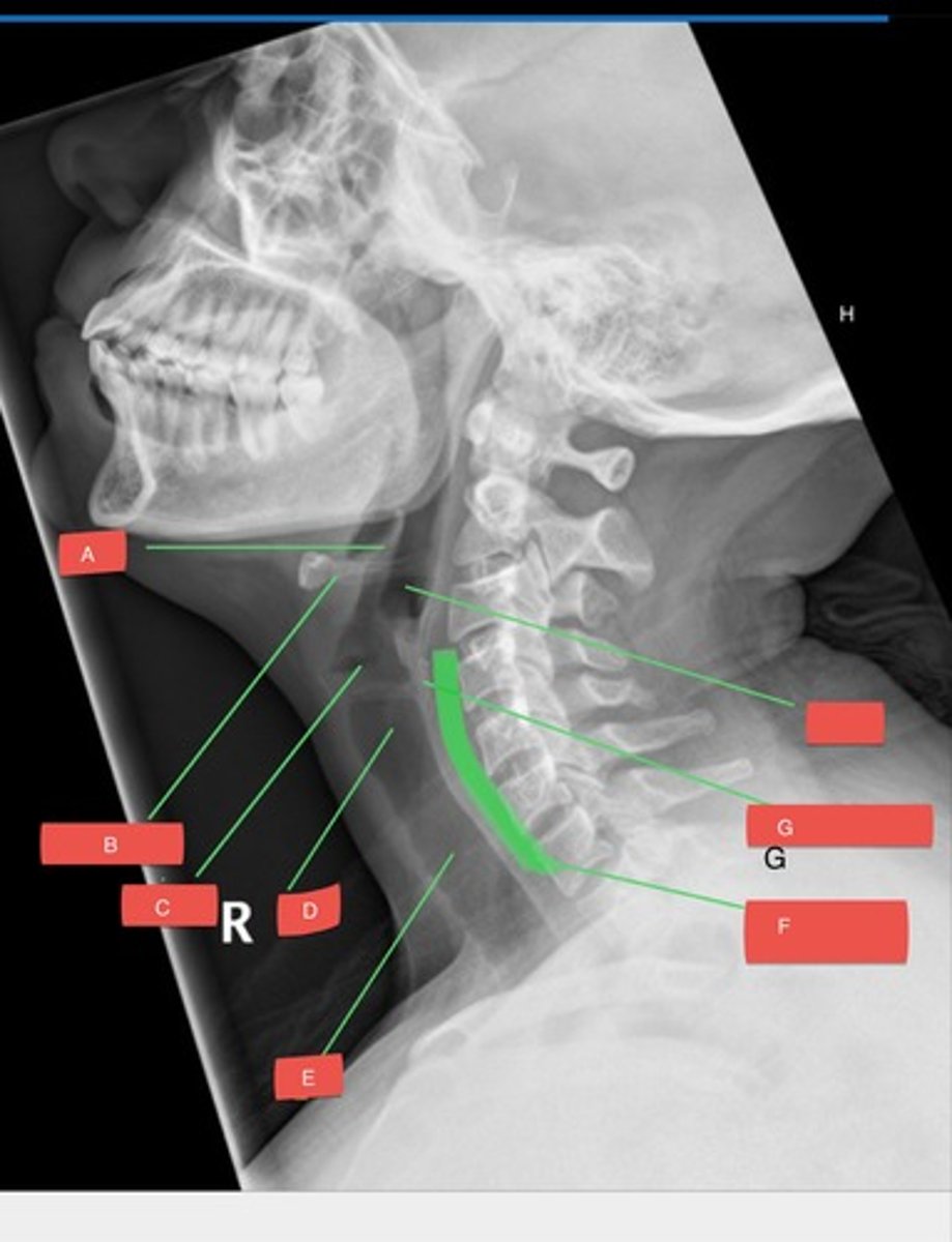 <p>E?</p>
