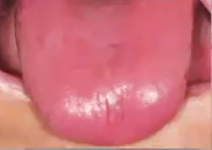 <p>what is the diagnosis </p>