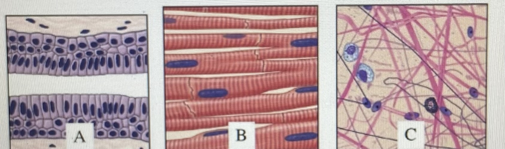 <p>for the image above select the group of terms that correctly identifies each tissue</p>