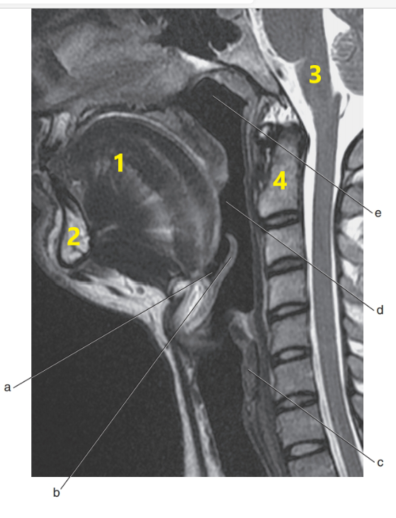 <p>What anatomy is letter e ?</p>