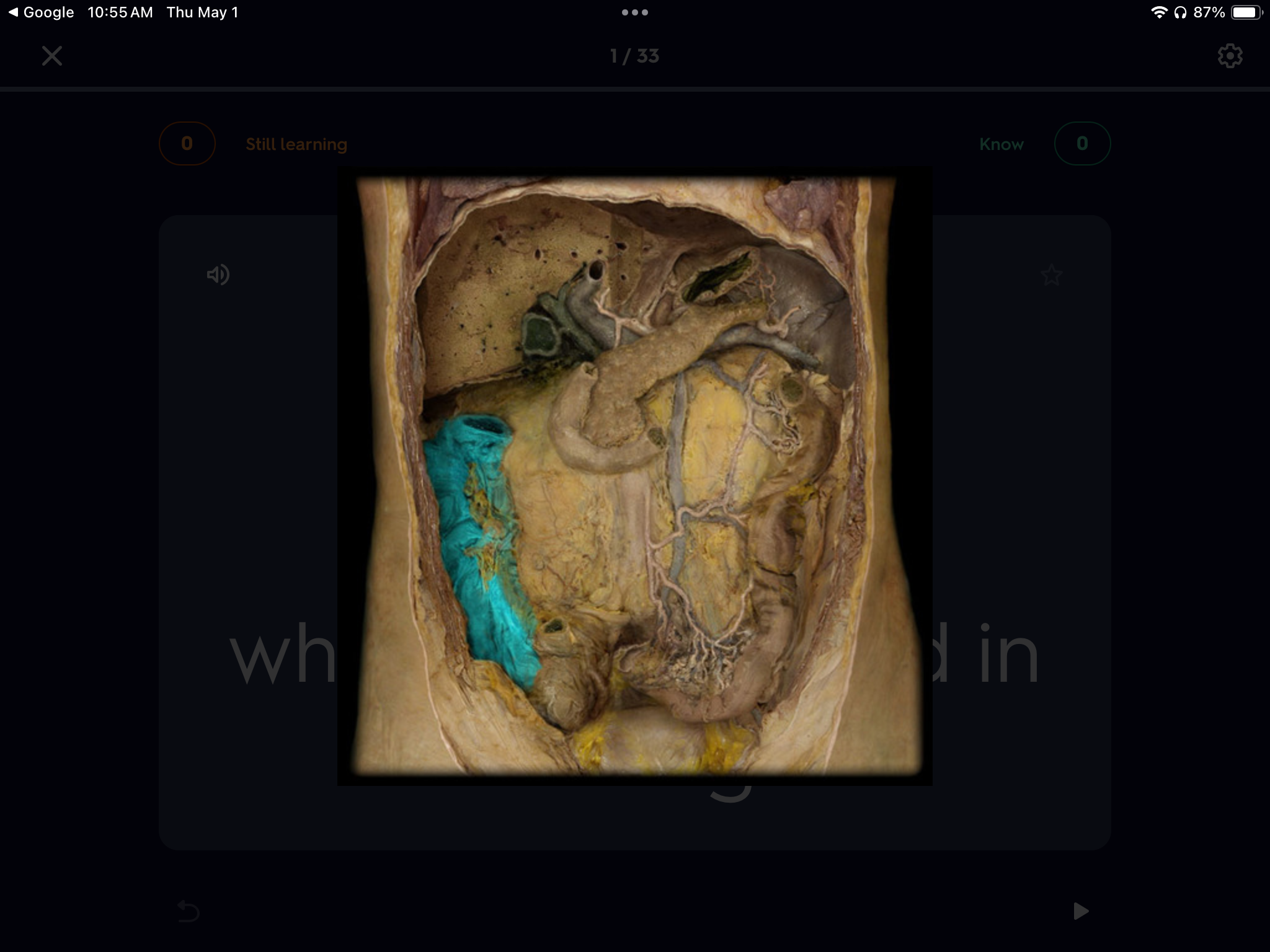 <p>What is the name of this highlighted structure part of the large intestine?</p>