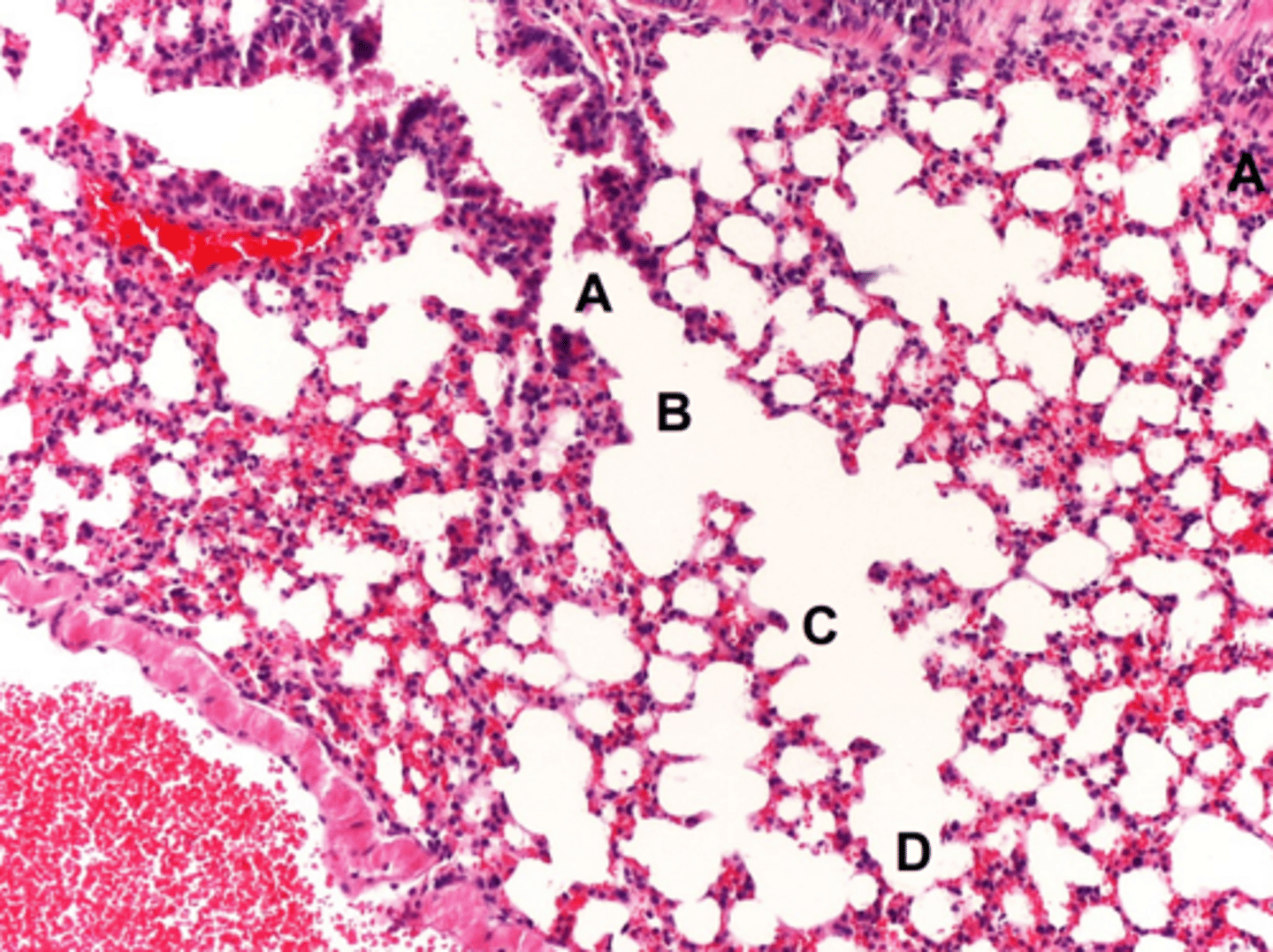 <p>c: airway</p>