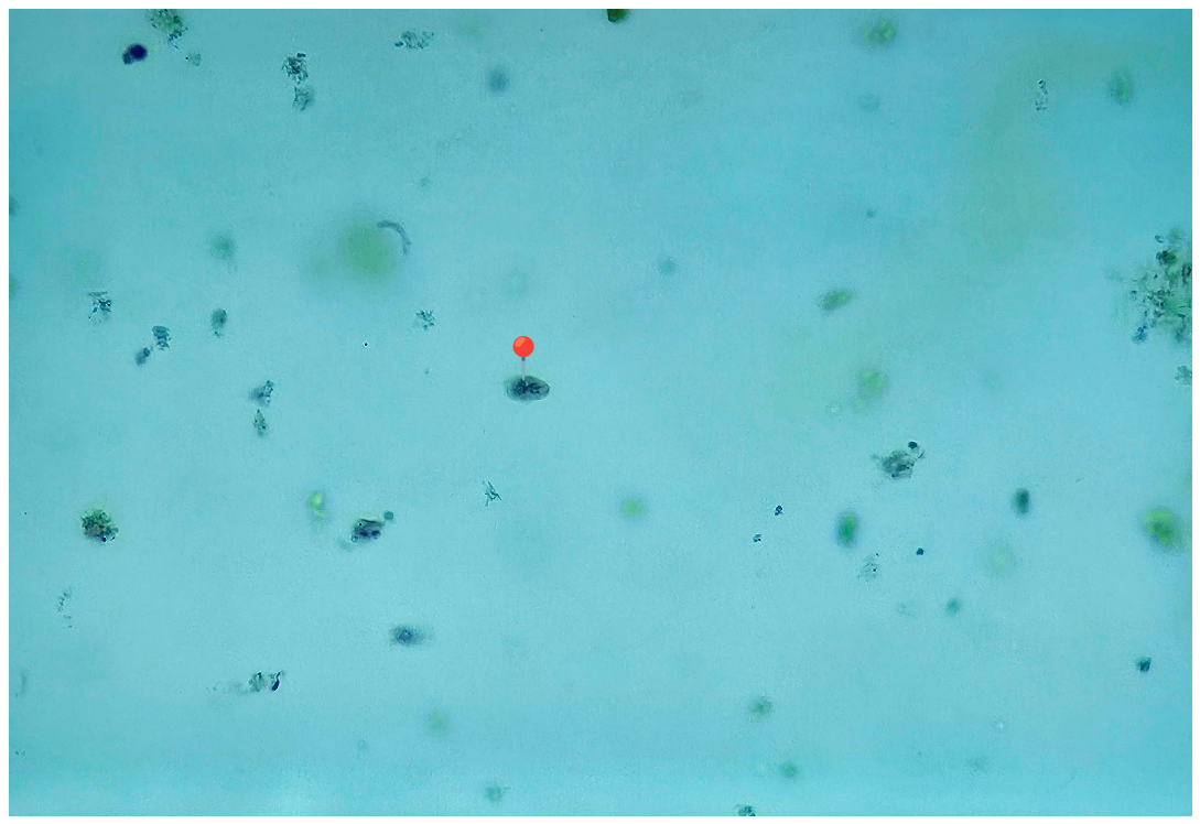 <p><strong><em>Giardia intestinalis</em></strong></p><p>(Trofozoit)</p><p></p><p></p><p><strong>Parazytoza:</strong> <em>Giardioza</em></p>