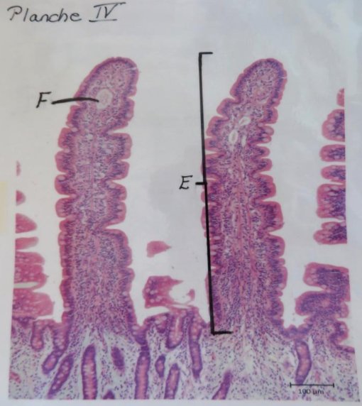 <p>Ampulla chyli</p>