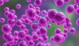<p>spherical cells</p>