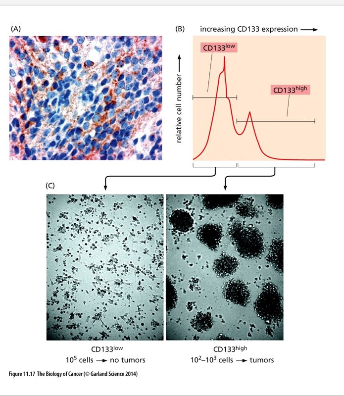<ul><li><p class="Paragraph WhiteSpaceCollapse SCXP140728914 BCX0" style="text-align: left"><span>(A) Medulloblastoma cells showing areas of high level of CD133 (dark red) expression and areas of low levels of expression​</span></p></li><li><p class="Paragraph WhiteSpaceCollapse SCXP140728914 BCX0" style="text-align: left"><span>(B) Cells derived from a human medulloblastoma sorted by FACS; shows 2 different subpopulations​</span></p></li><li><p class="Paragraph WhiteSpaceCollapse SCXP140728914 BCX0" style="text-align: left"><span>(C) one population forms tumors in culture, the other does not​</span></p></li><li><p class="Paragraph WhiteSpaceCollapse SCXP140728914 BCX0" style="text-align: left"><span>CD 133 – marker used to identify neural stem cells​</span></p></li></ul><p></p>