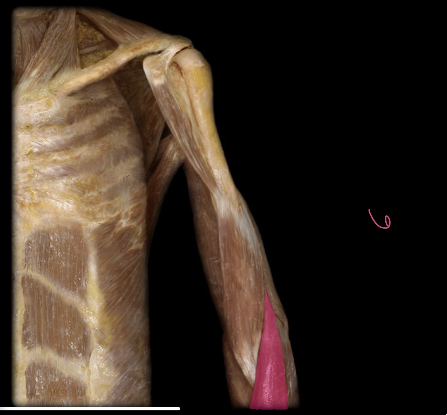 <p>Brochioradialis m</p>