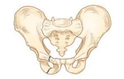 <p>Pelvic Fracture</p>