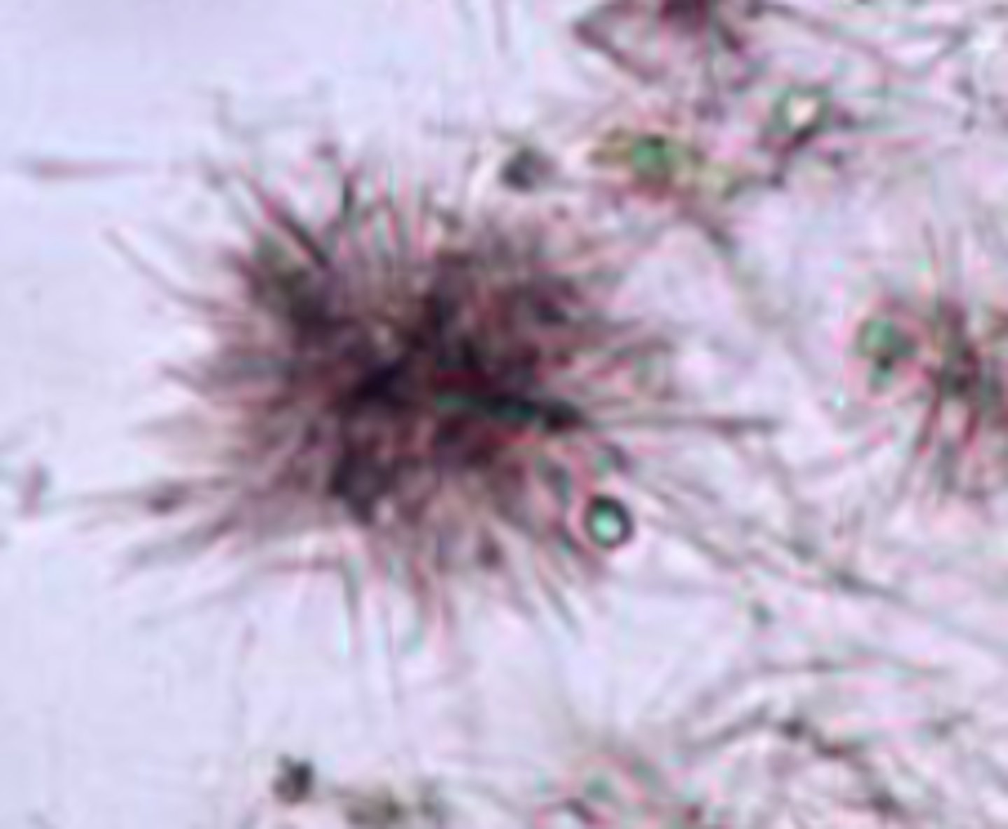 <p>- Dark, needle-like projections</p><p>- Highly refractile</p><p>- Indicate liver disease</p><p>- Not common in dogs and cats</p>