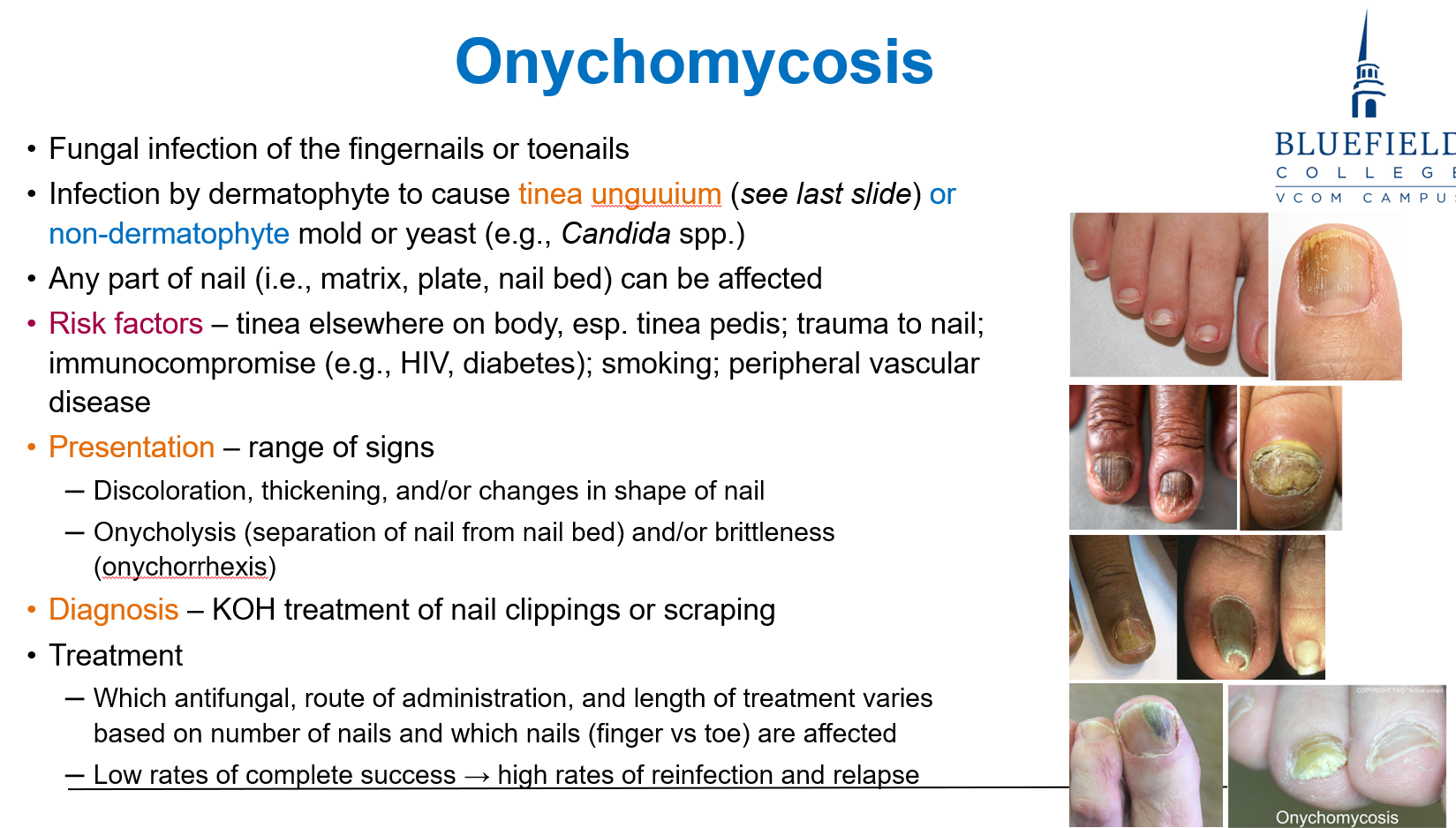 <p>A <strong>fungal infection of the fingernails or toenails</strong>, caused by:</p><ul><li><p class=""><strong>Dermatophytes</strong> (leading to <strong>tinea unguium</strong>)</p></li><li><p class=""><strong>Non-dermatophyte</strong> molds or <strong>yeasts</strong> (e.g., <em>Candida</em> spp.)</p></li></ul><p></p><p><em>Ony = Onyx meaning nail</em></p>