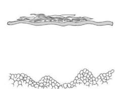 <p>Pérdida de células del estrato cornificado que se acumulan en forma de platos delgados sobre la superficie de la piel.</p><p>Ictiosis, alergias, secundario a infecciones</p>
