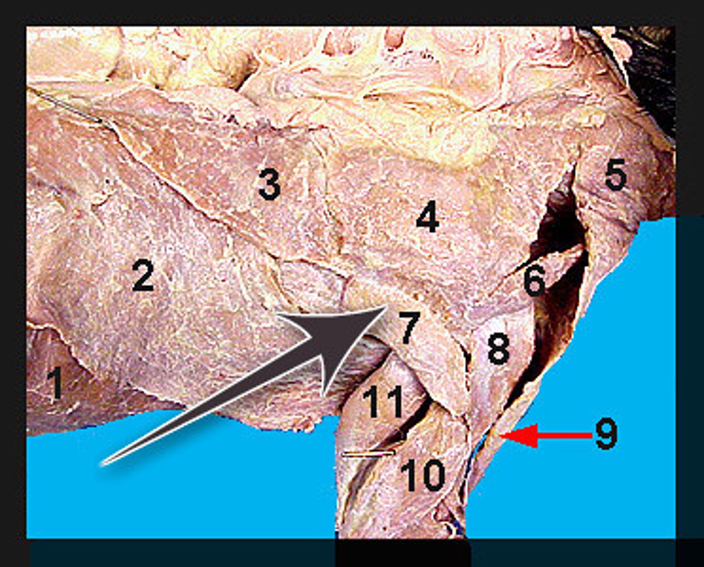 <p>Identify what the brown arrow is pointing to; also labeled number "7"</p>