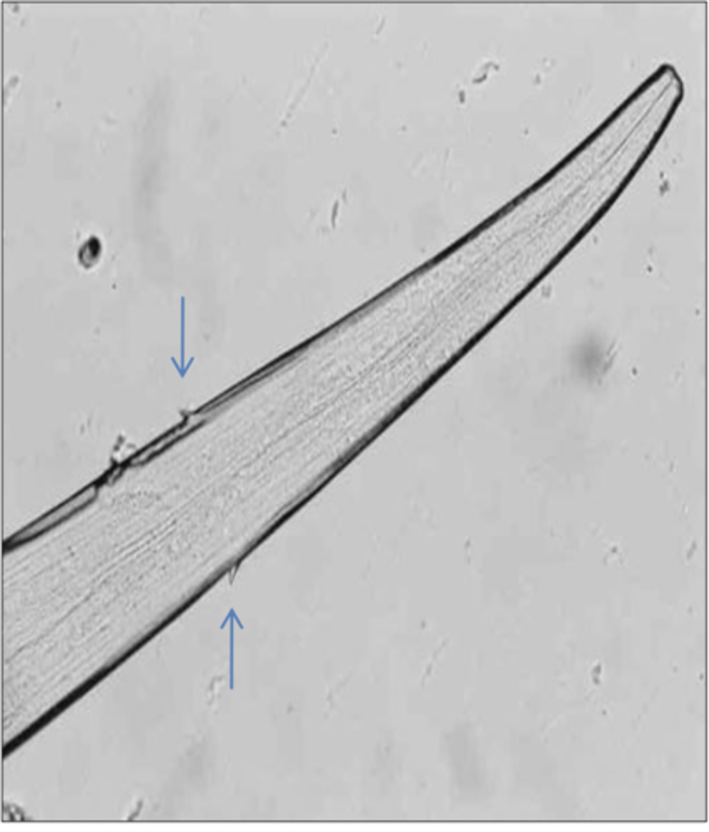 <p>What is this parasite? What characteristic/s did you use to identify it?</p>