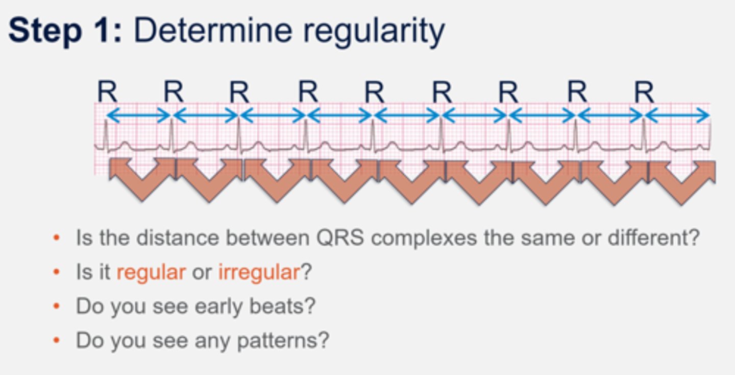 <p>Measure the intervals between P to P waves or R to R waves</p><p>If the intervals vary by less than 0.06 seconds or 1.5 small boxes, we can consider the rhythm to be regular</p>