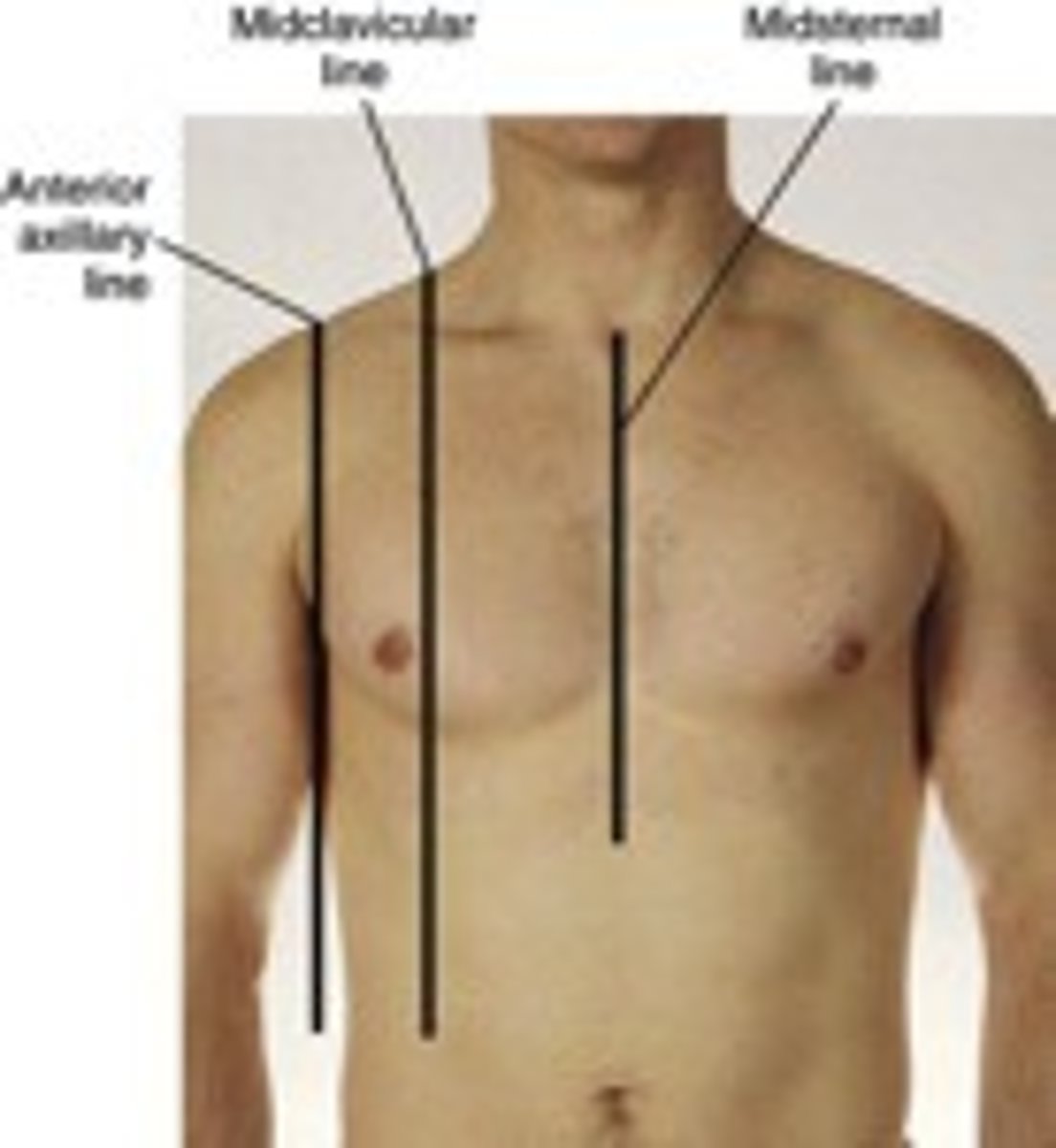 <p>midclavicular; subcostal</p>