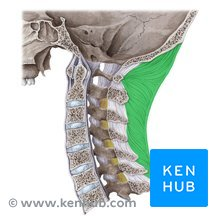 <p>What <strong>Cranial or Neck <u>Ligament </u>is this?</strong></p>