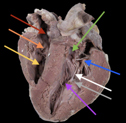 <p>where chordae tendineae attach, grey arrow</p>