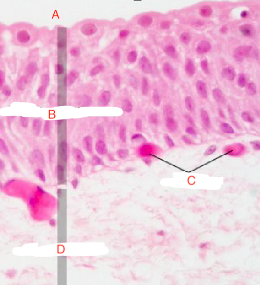 <p>Transitional Epithelium </p>