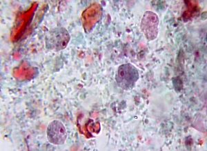 Endolimax nana trophozoite