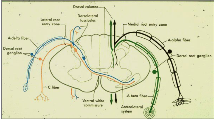 <p>dorsal solumn = heavily myelinated</p><p>spinothalamic = poorly myelinated or unmyelinated</p>
