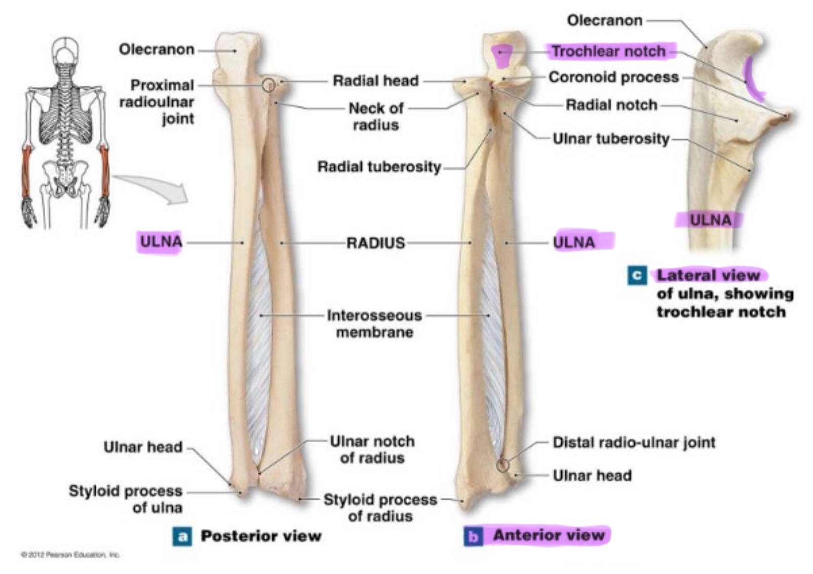 <p>deep, curved notch between the olecranon & coronoid processes; articulates w/ trochlea of humerus to form part of elbow joint</p>
