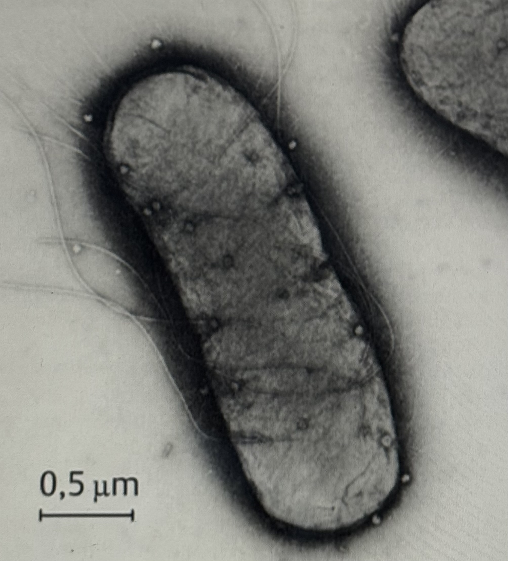 <p>Escherichia coli Steckbrief</p>