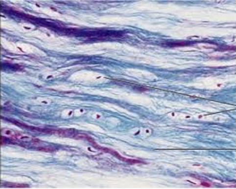 <p>A tough, flexible type of cartilage that provides support and absorbs shock. It is found in intervertebral discs, pubic symphysis, and menisci in the knee. </p>