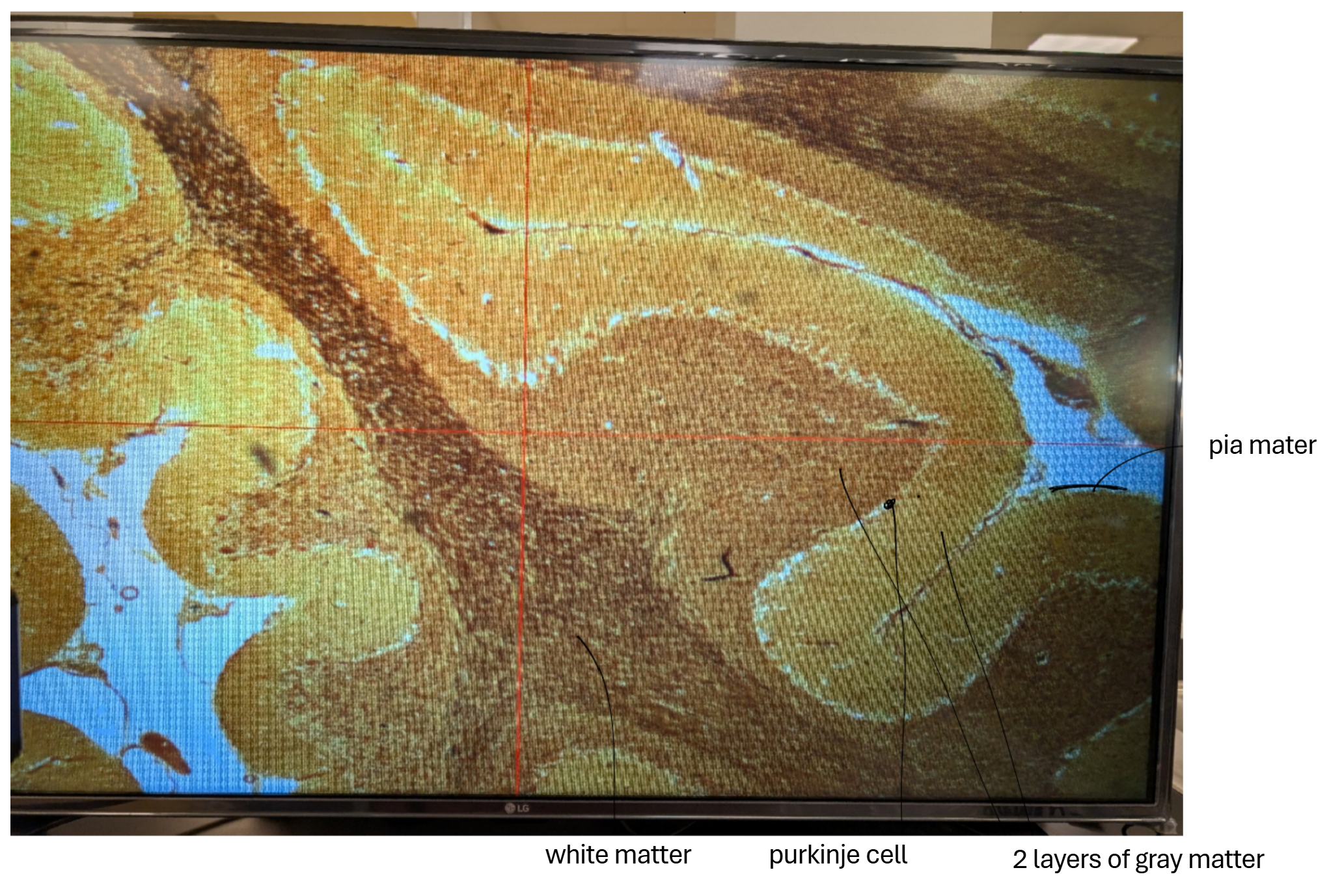 <p>what tissue is this and what stain?</p>