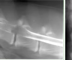 <p><span><span>Identify the pathology?</span></span></p>