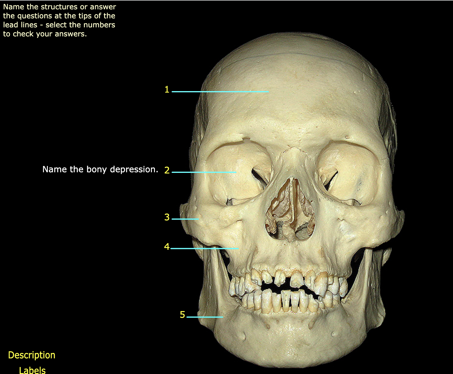 What structure is labeled 2?