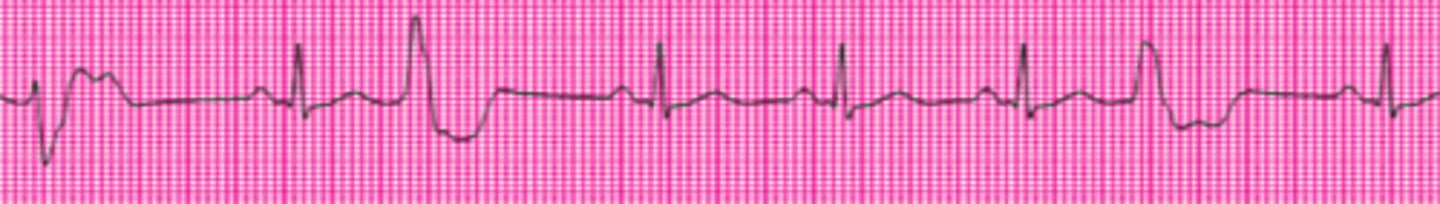 <p>Name this rhythm.</p>