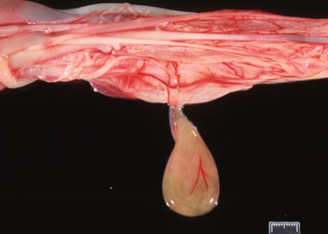 <p>What is this on the umbilical cord?</p>