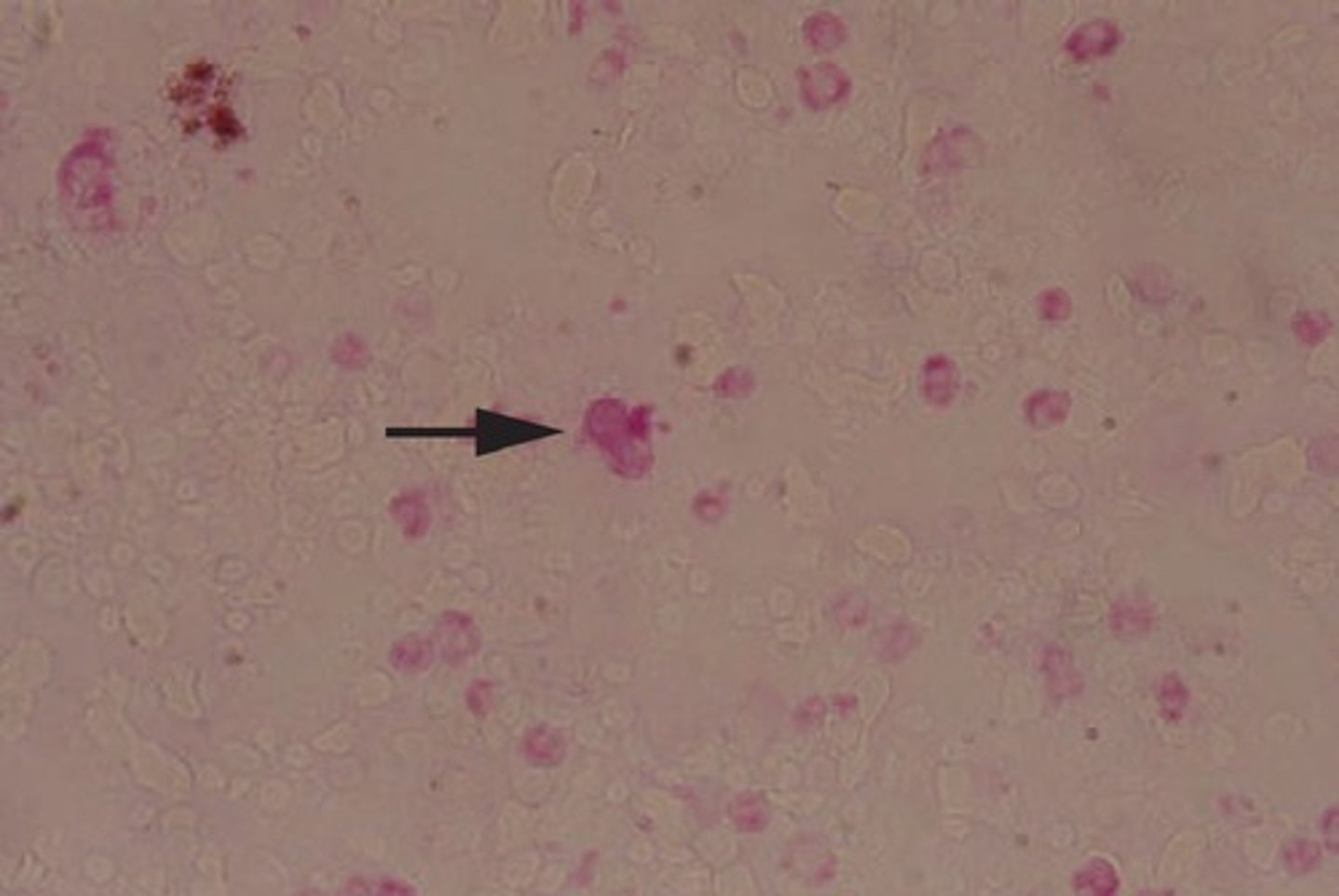 <p>a. Blastomyces dermatitidis</p>