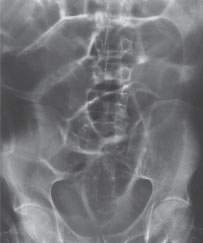 <p>How would the pathology evident be categorized?</p>