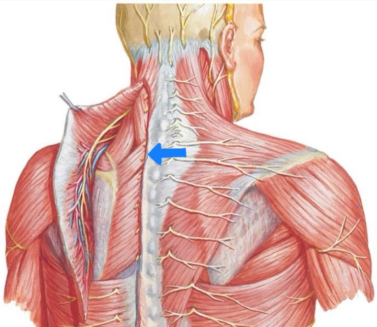 <p>Rhomboid Minor</p>