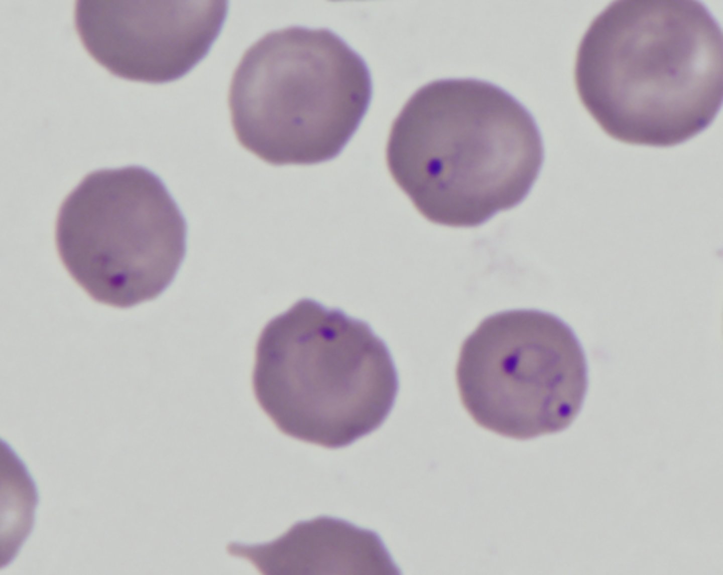 <p>Little organisms (3 to 5 um) that look like these were seen on a blood smear of a Burmese fighting dog. What are they:</p>