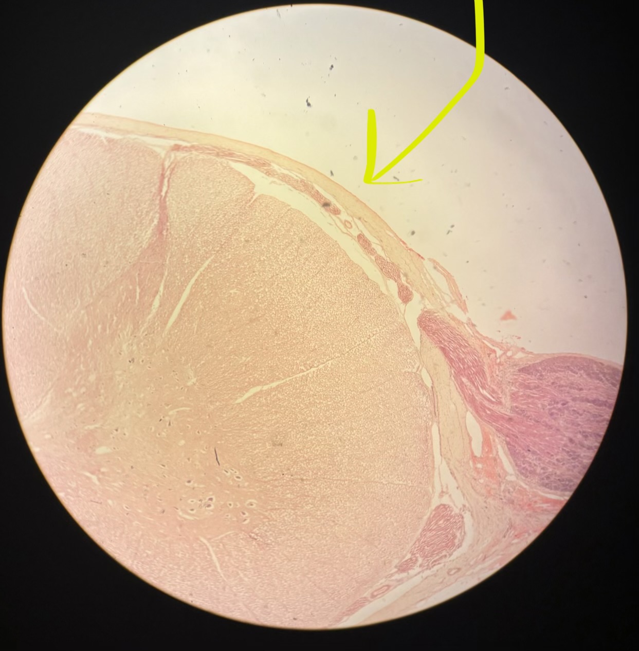 term image