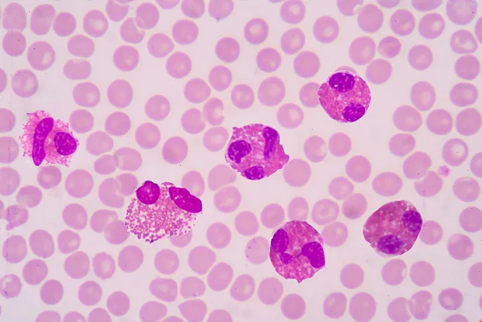 <ul><li><p>12-17 u</p></li><li><p>cytoplasm filled with red-orange, spherical granules</p></li><li><p>dense nuclear chromatin</p></li><li><p>segmented nucleus</p></li></ul><p></p>
