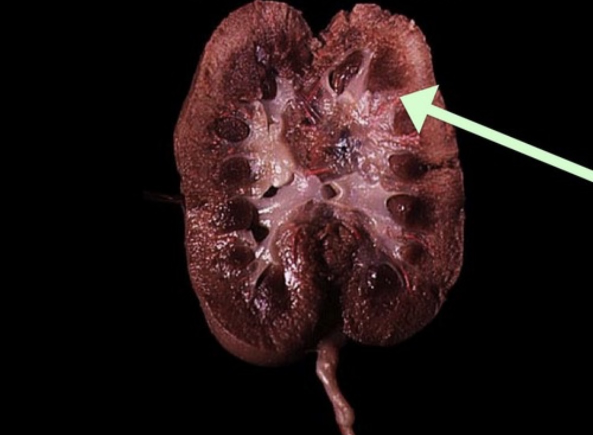 <p>Inward extension of cortical tissue separating adjacent renal pyramids.</p>
