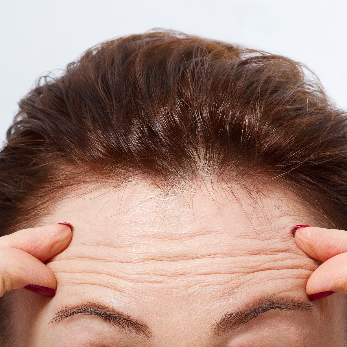<p>wrinkles </p>
