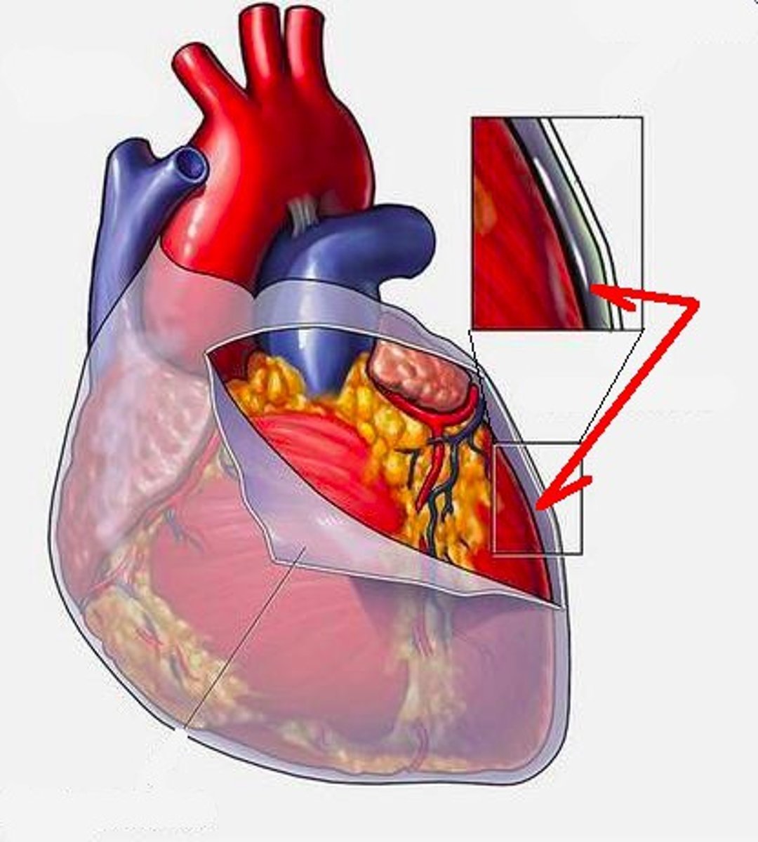 <p>probe between the 2 layers</p><p>space</p>