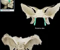 <p>paired, flattened bony projections of the sphenoid bone located on the inferior skull medial to the lateral pterygoid plate; form the posterior portion of the nasal cavity lateral wall</p>